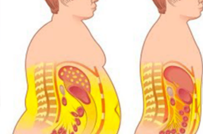 رجيم الكرش رجيم سهل للتخلص من الكرش فى ايام