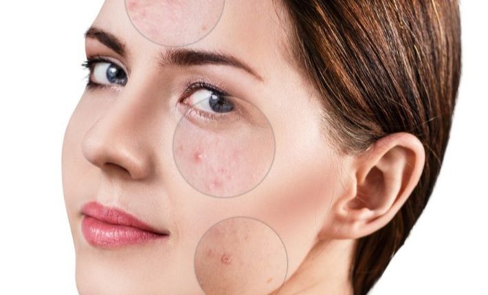 تست تفتيح بشرة